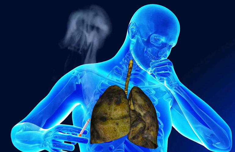 cough-fever