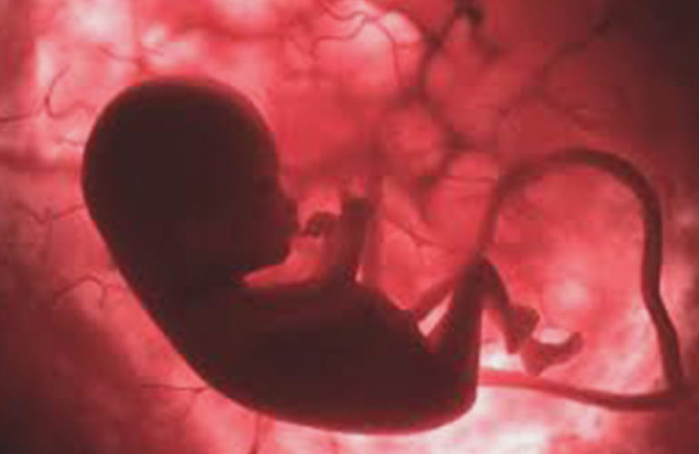 gynecological-disorders
