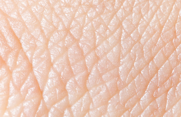 skin-disease