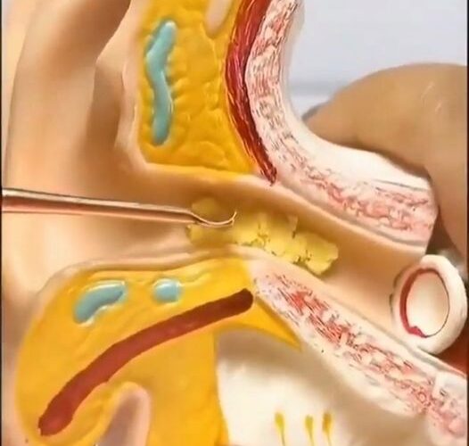 ear-infection