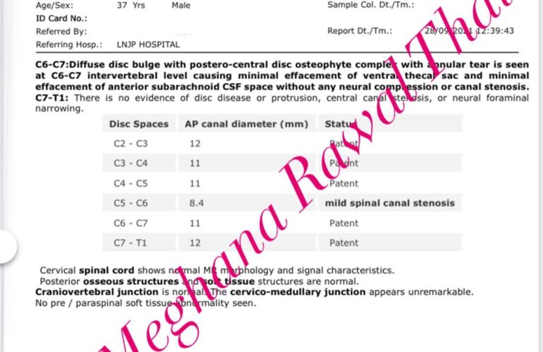 SPINAL CORD TUMOR