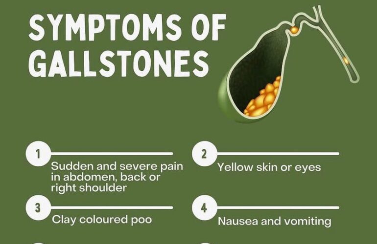 GALLSTONE & HOMOEOPATHY