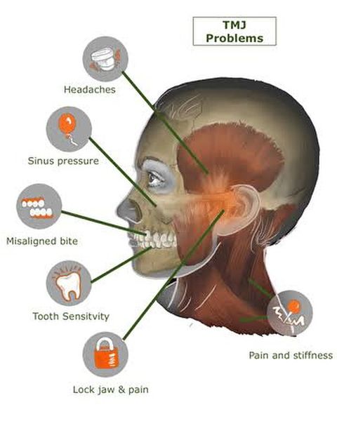 Temporomandibular joint (TMJ) disorders