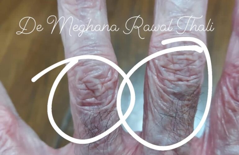 eczema
