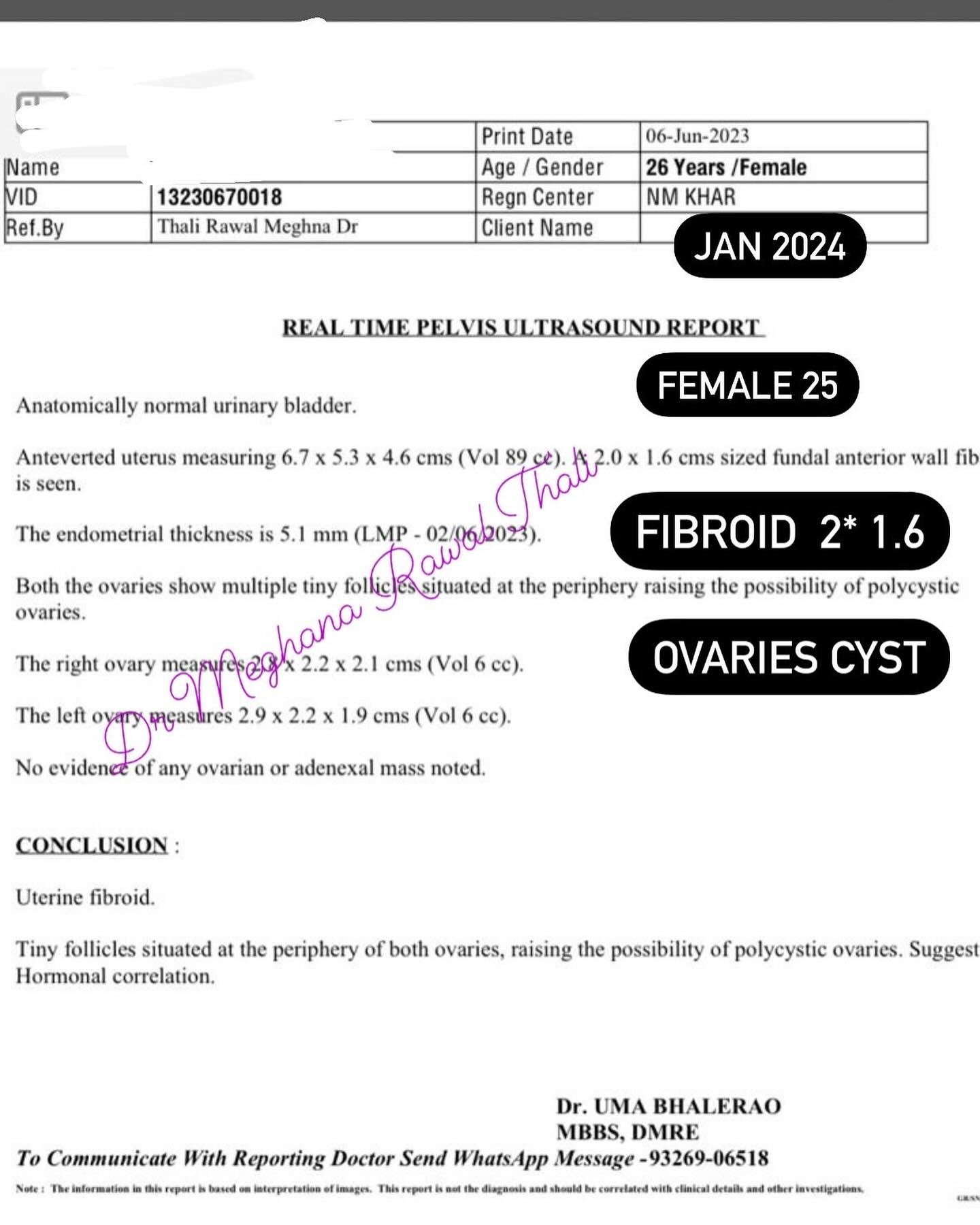 PCOD & FIBROID