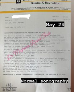 PCOD-FIBROID1