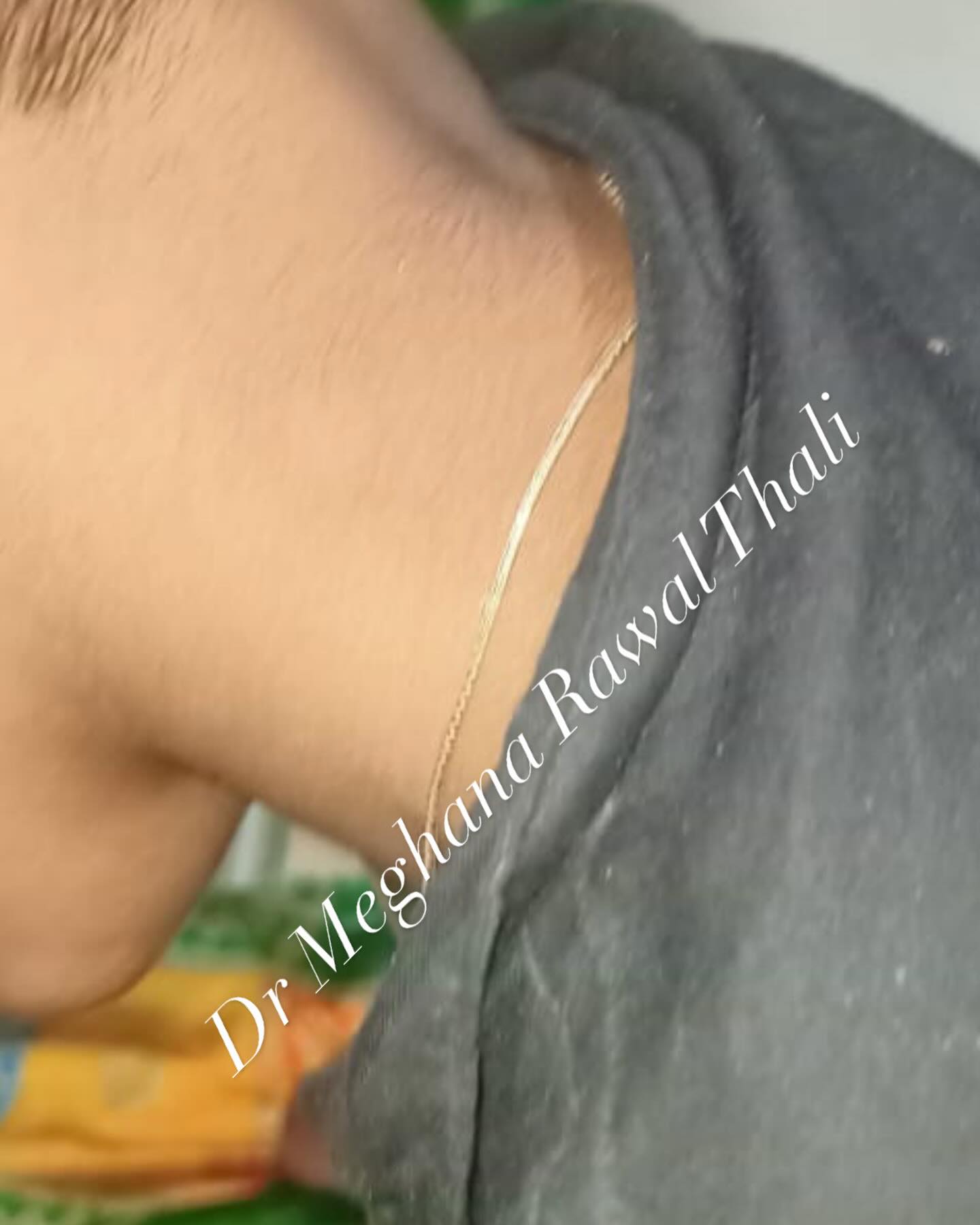 Cervical adenopathy